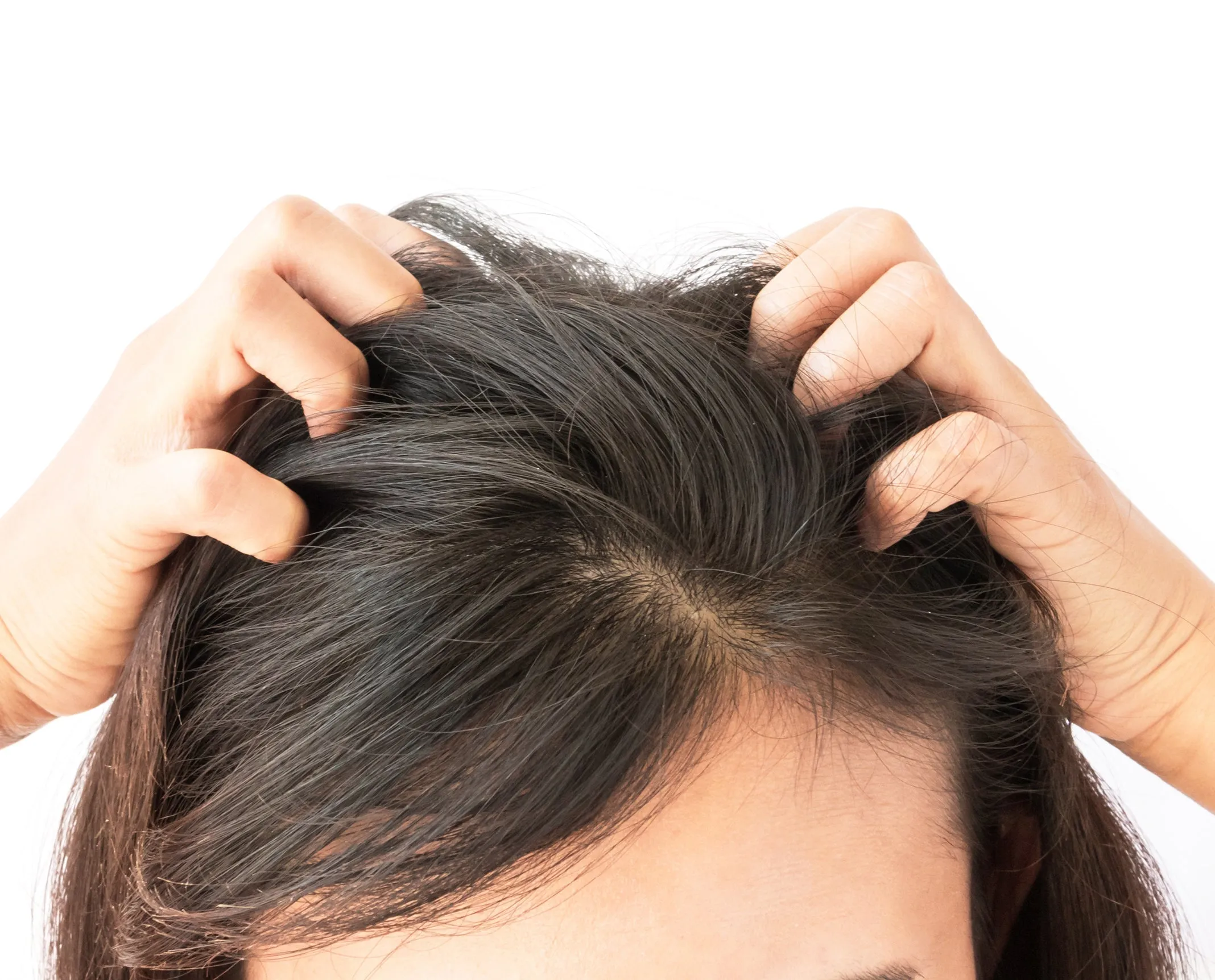 Difeel Scalp Care 99% Natural Premium Natural Hair Oil - Tea Tree Oil 8 oz.