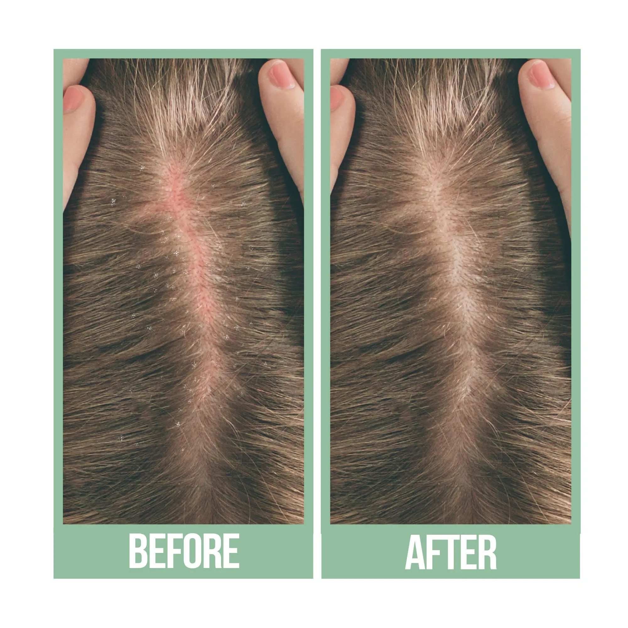 Difeel Scalp Care 99% Natural Premium Natural Hair Oil - Tea Tree Oil 8 oz.